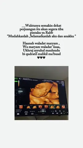 30weekk hpl oktober 2024❤️❤️ #CapCut #pregnant #30weekspregnant #hploktober2024 #folamilgenio #trimester3 #bismillahfyp #bumil #usg4d 
