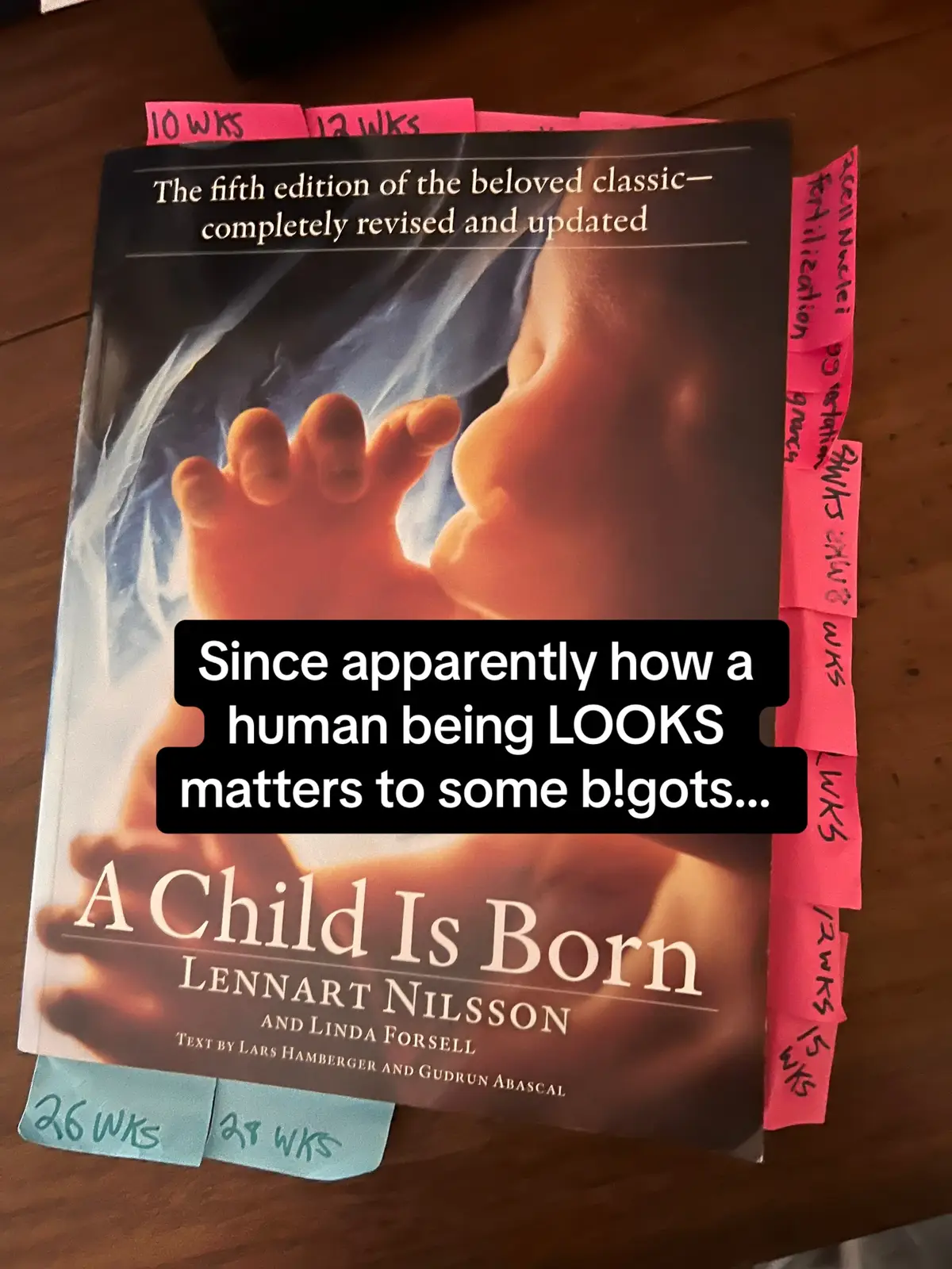 When you add anything more then being human for who gets human rights and who doesn’t, it never ends well. Be on the right side of history. #fyp #endchildsacrifice #abortionabolitionist #abolitionist #fetus 