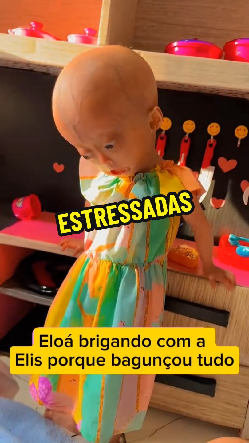 #CapCut #viralnotiktok #sindomedavelhice #sindromerara #viralizarnotiktok #progeriaresearchfoundation #progeria #sindromedeprogeria #eloaeelis #eliseloa #eliseeloa #velhiceprecoce #gemeasidenticas 