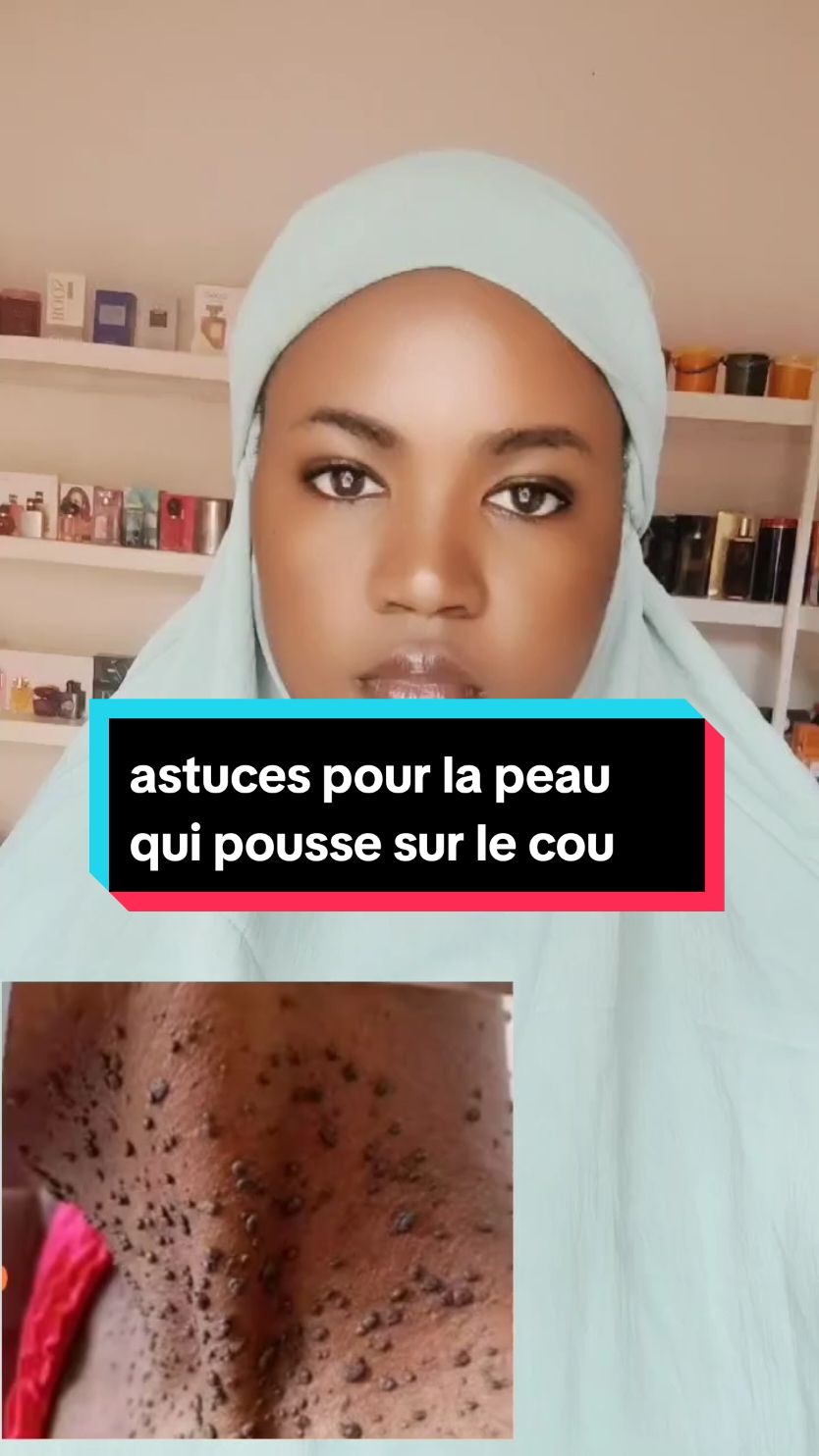 astuces très simples à réaliser #acne #bamakomali🇲🇱 #cotedivoire🇨🇮 #malitiktok🇲🇱 #togolais228🇹🇬 