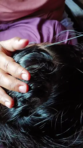 #lice #licetreatment #hair #fyp #liceasmr 