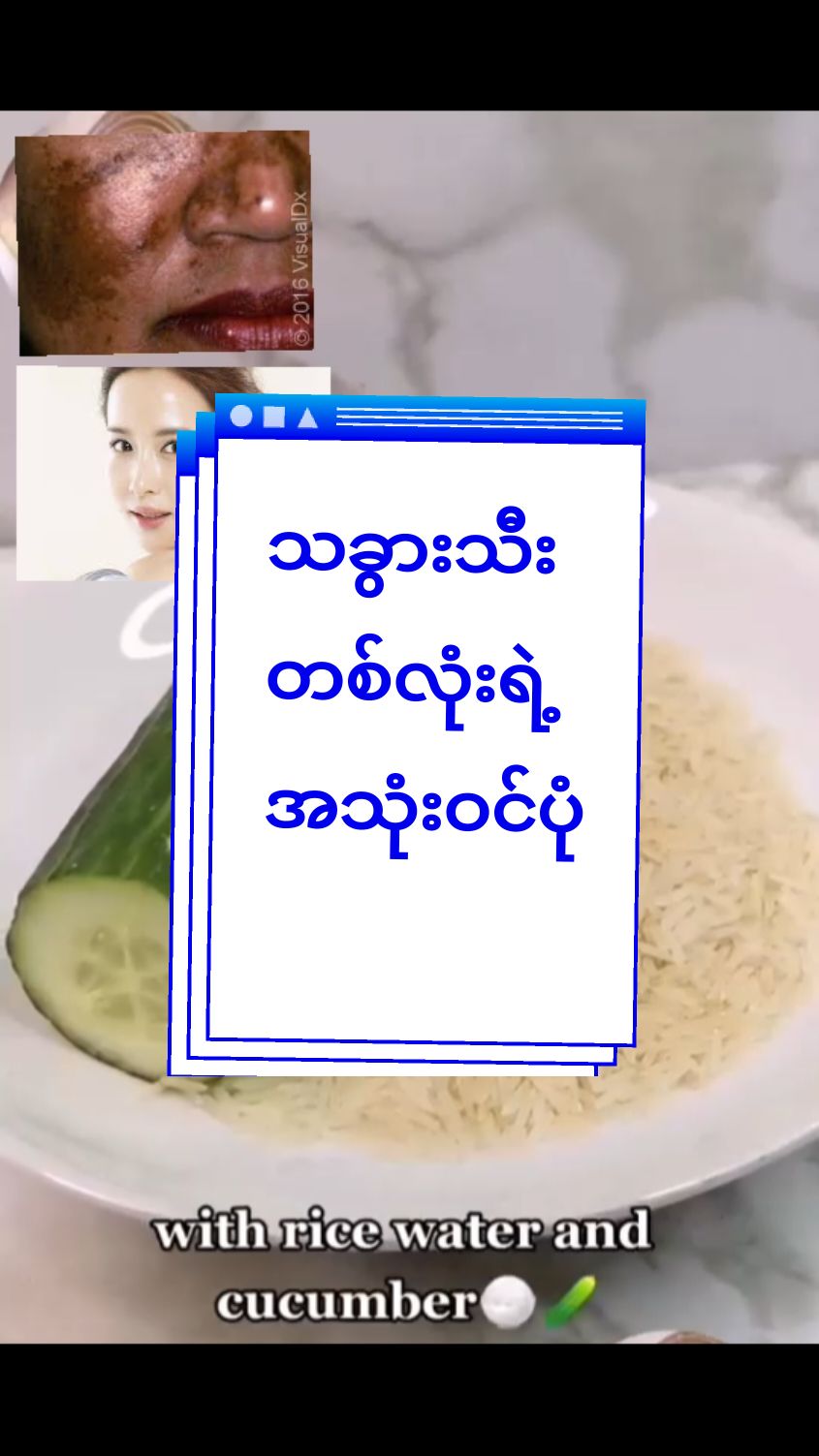 သခွားသီးရဲ့အသုံးဝင်ပုံ#မျက်နာဖြူဝင်းစေဖို့ #တင်းတိပ်အမဲစက်ပြောက်ချင်သူများအတွက် #titokmarketing #thinkb4youdo #skincare #madeinkorea #titokmyanmar #beautysharing #1M #mohmoh #WhiteZone #Knowledgesharing #သဘာဝနည်းလမ်းလေးရှိတယ်😍 #knowlwdge 