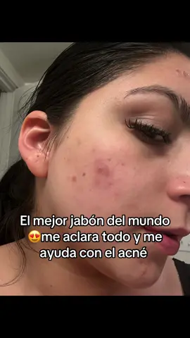 Para mi es el mejor pero tampoco es magia es constancia 😍🌸#jabonesartesanales #aclararlapiel #acne #hormonales #curcuma #tumeric #soap #for #foryoupage #viral 