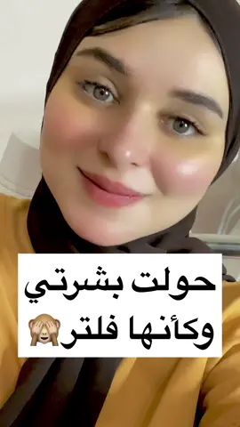 الاسكين بوستر عندنا مختلفه لاننا مش بنستخدم نوع واحد زي اي عياده احنا بنستخدم ٣ انواع للنضاره والشد والتفتيح#بشرة_صافيه #اكسبلور_تيك_توك #روتين_العنايه_بالبشره #روتين_العنايه_بالبشره #جلديةوتجميل #بشرة_صحية #روتيني_اليومي #جلسة_نضارة_وتنظيف_طبي_عميق_للبشرة #تقشير_وتبييض #تنضيف_بشرة #تجميل 