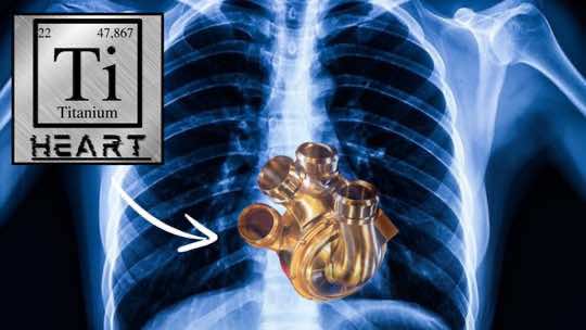 Breakthrough: Titanium Heart Transplant #Medicine #Surgery #Science #Titanium #Titanio #Titaniumheart 