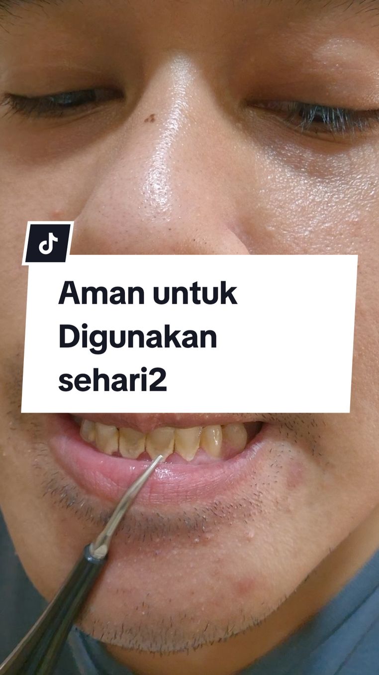 Membalas @milaaaaaaawwwwwwuuuualat pembersih karang gigi ini cocok untuk harian, bisa digunakan sehari hari apabila plak atau karang gigi kalian sudah mulai muncul. #alatpembersihkaranggigi #pembersihkaranggigi #karanggigi 