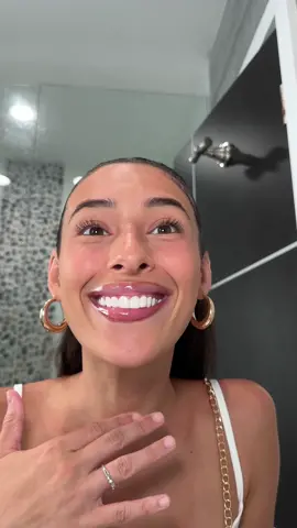 Love these! 🤍 Get 15% OFF your snap-on veneers using my personal code: Social20 and shop now! @Shiny Smile Veneers  . . #snaponveneers #veneers #smile #ShinySmile