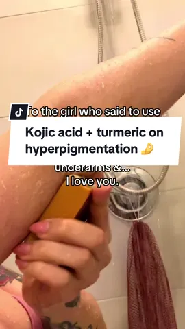 Go read the reviews yall 😩 tiktok had my back with this one #hyperpigmentation #kojicacid #darkinnerthigh #darkelbows #darkunderarms #creatorsearchinsights  kojic acid soap tagged from tiktok shop 🫶
