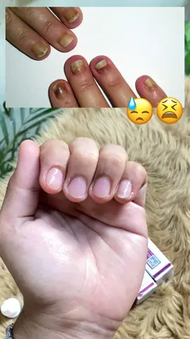 RtopR Ginger Nail Essence #gingernailessence #nailtreatment #nailcare #rtopr 