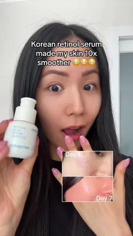 Soo good esp for acne-prone skin types 🫣💖 #koreanskincare #koreanskincareproducts #kbeauty #kbeautyskincare #retinol #koreanretinol #retinolskincare #koreanserum #retinolserum #koreanskincaretips #largepores #kbeautyproducts #koreanbeautyproducts #koreanbeautysecret #innisfreeretinolcica 