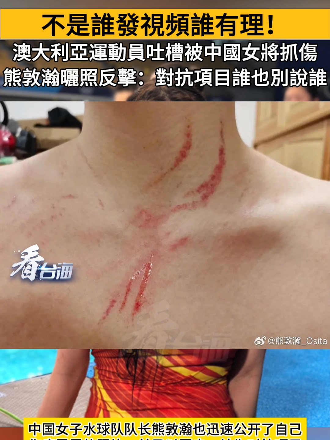 澳大利亞運動員吐槽被中國女將抓傷 熊敦瀚曬照反擊：對抗項目誰也別說誰。 #奧運 #巴黎 #王昶