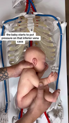 Supine hypotensive syndrome 