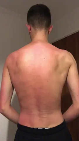 Back gains 😳 skinny guy transformation #jacksfit