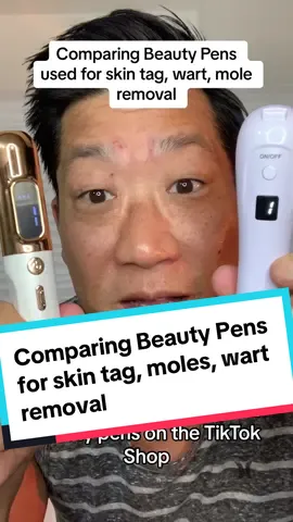 Comparing beauty pens for skin tag mole and wart removal #skintagremoval #beautypen #koreanskincare #skincareroutine #comparison  