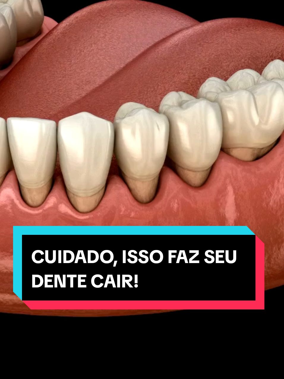 CUIDADO, ISSO FAZ SEU DENTE CAIR!  #gengivite #dentes #dordedente 