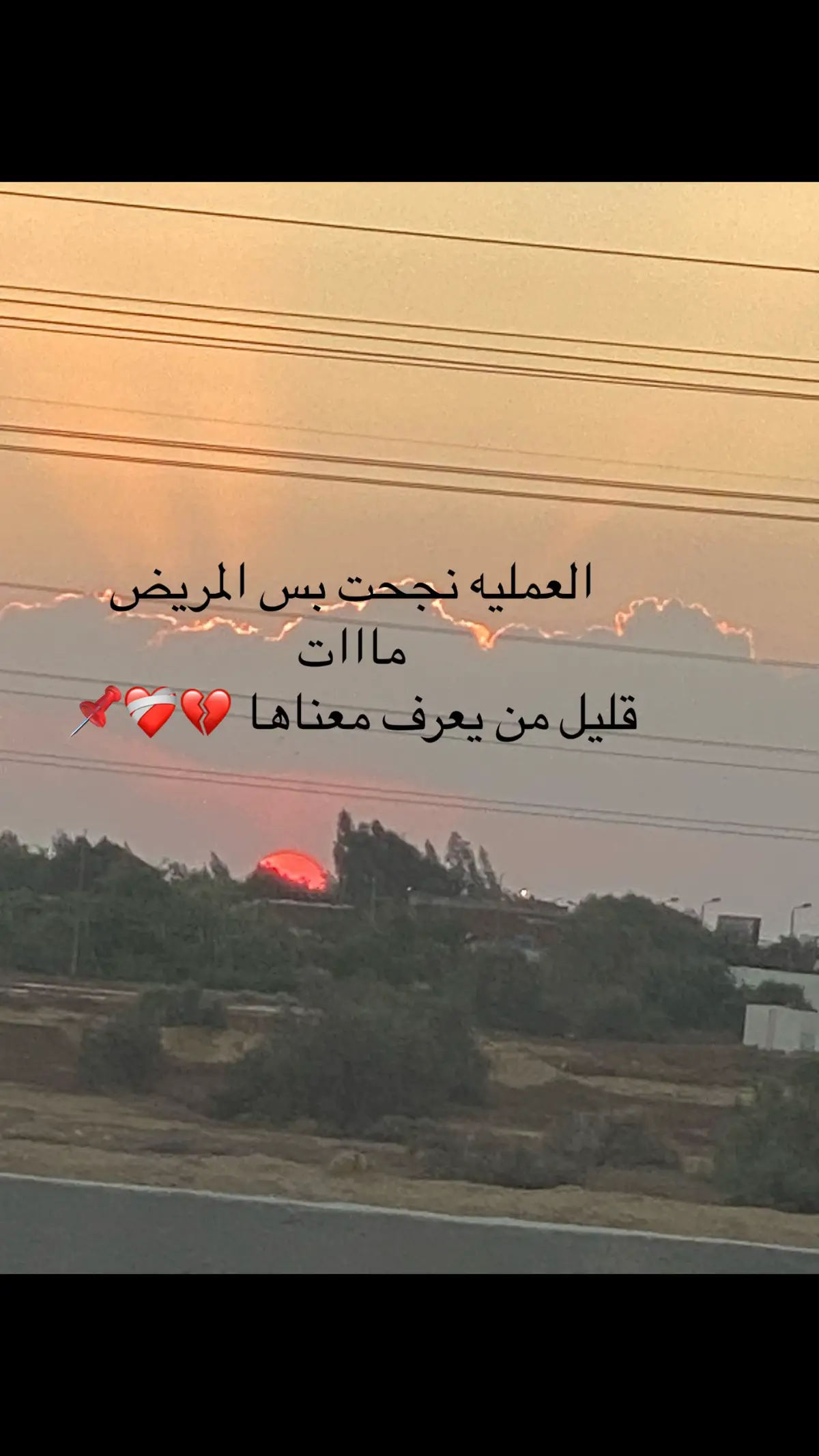 أنشئت من الجرح لكن ماعادات الروح تشتهي لشيء🌹🌹🌹