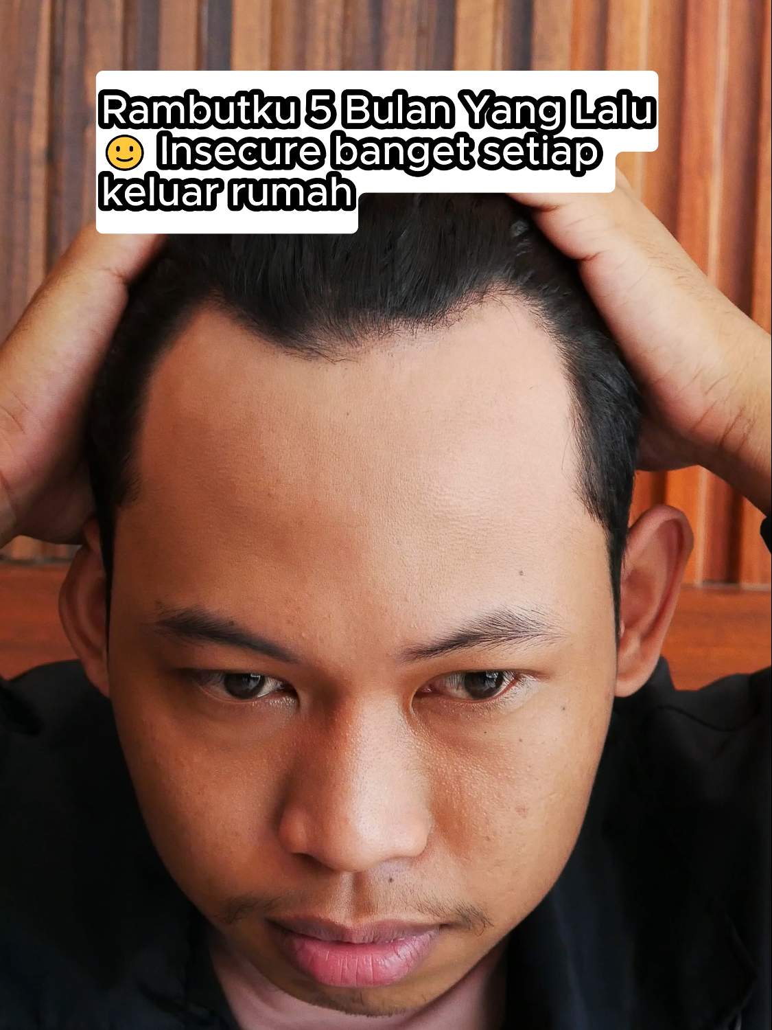 Berjuang dari kebotakan sangat membuat aku struggle dan hampir menyerah, setelah nemuin hair tonic ini aku sangat bersyukur bisa tumbuhkan rambutku dengan permanen. #haircare #kebotakan #flohairtonic