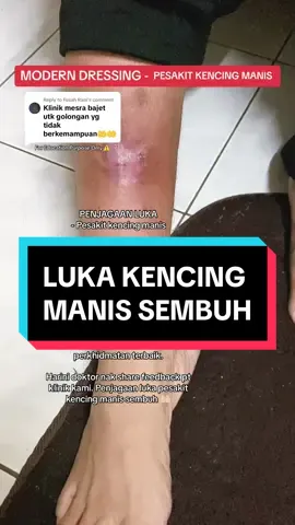 Replying to @Fuzah Rani Penjagaan Luka Pesakit kencing manis. 𝗣𝗘𝗠𝗕𝗘𝗗𝗔𝗛𝗔𝗡 𝗞𝗘𝗖𝗜𝗟 (𝗠𝗜𝗡𝗢𝗥 𝗦𝗨𝗥𝗚𝗘𝗥𝗬) Modern Wound Dressing - 𝗥𝗮𝘄𝗮𝘁𝗮𝗻 𝗯𝗲𝗿𝗸𝘂𝗮𝗹𝗶𝘁𝗶 𝘂𝗻𝘁𝘂𝗸 𝗹𝘂𝗸𝗮 𝗯𝗲𝘀𝗮𝗿 & 𝗸𝗲𝗰𝗶𝗹. Alhamdulillah  Terima kasih semua 🤲🏻 insyAllah doakan kami semoga sentiasa mampu memberikan rawatan @ perkhidmatan terbaik untuk masyarakat. #fypシ #fyp #foryou #klinikziadazhari #klinikziadmelor #fypシ゚viral #satisfying #diabetes #fypp #kencingmanis #kelantan #klinikkelantan #doktor #tiktok #fypdongggggggg 