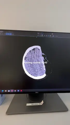 Replying to @Dennis tuesday  #Vlog #asmr #medstudent #surgery #hospital #medicine #neurosurgery #greysanatomy #medizin #GymTok #Fitness #frankfurt #fyp #fürdich 