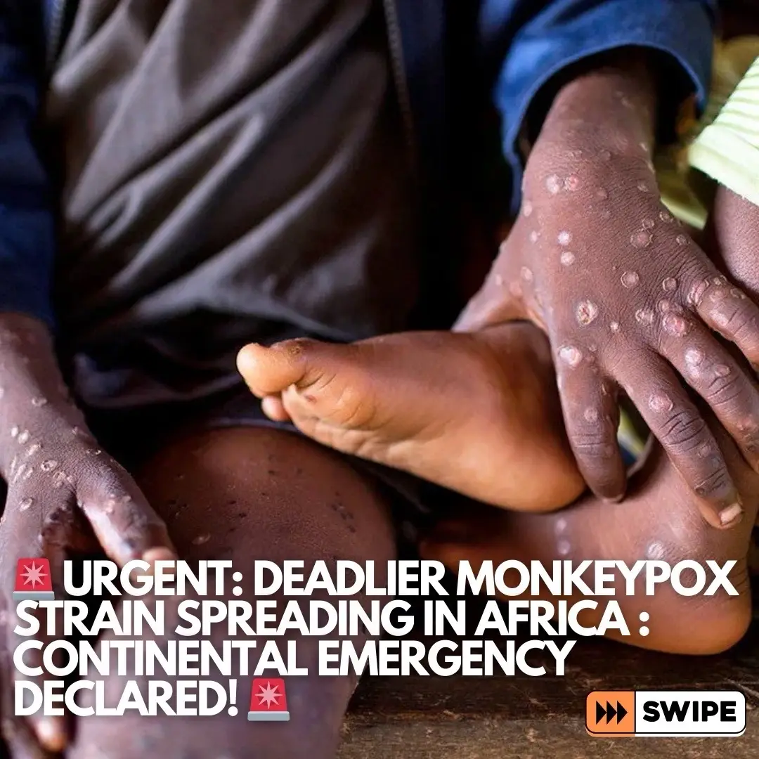 Deadlier Monkeypox Variant spreading in Africa causing a continental wide emergency. Urgent Action needed to prevent a new Pandemic!🚨⚠️ #Africa #MonkeyPoxInAfrica #PandemicAlert #HealthEmergency #Virus #Covid19 #Fyp #viral #BreakingNews #IBTimesUK