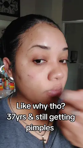 This snail mucin better hurry up n soothe out Bertha #contentcreator #fypage #skincare #pimple #acne #snailmucin 
