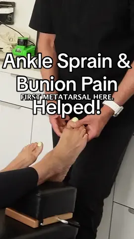 Ankle Sprain & Bunion Helped!  What do you do if you have a bunion?  In my 20 years of clinical practice and from my training this is how I’ve helped and even fixed bunions in the past. When looking at any foot issues, 85% of all foot dysfunctions start with a misaligned talus, usually misaligned Anterior and superior(AS), with either medial or lateral tilting. This fixation in the hind foot causes hyper mobility in the mid- and forefoot. The body starts to compensate and can lead to other compensatory misalignments in the foot, including the formation of a bunion, Hallux Valgus. I’m not speaking about conditions where people are born with bone deformities in the foot. In this video, I explain the basic process of bunion formation from misalignments in the foot and the way to correct them. This protocol is performed after any spinal misalignments and nerve pressures have been corrected prior to adjusting the foot. #drrahim #gonstead #chiropractor #helped #footpain #sprainedankle #talus #fibula #calcaneous #cuboid #navicular #fist #metatarsal #capsular #swelling #sesamoid #chiropractic #extremity #adjustment #foryou #fyp #gonsteadwellness #losangeles #dubai🇦🇪
