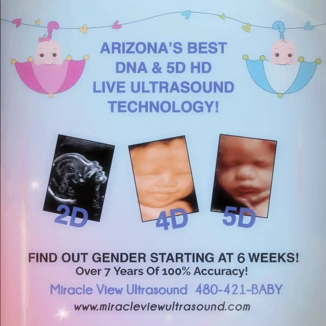 - Elective Ultrasounds Starting At Just 10 Weeks Along.  - DNA Early Gender Determination Starting At Just 6 Week Along. Visit our website for package details, current Specials, and full pricing info: MiracleViewUltrasound.com/pricing.html  480-421-BABY (2229) 480-221-9171 (Text Only Line) #5dultrasound #genderreveal #phoenixarizona #itsagirl #itsaboy #maternity #secondtrimester #pregnantlife #preggo #preggy #expectingmom #firsttrimester #thirdtrimester #pregnant #pregnacy 