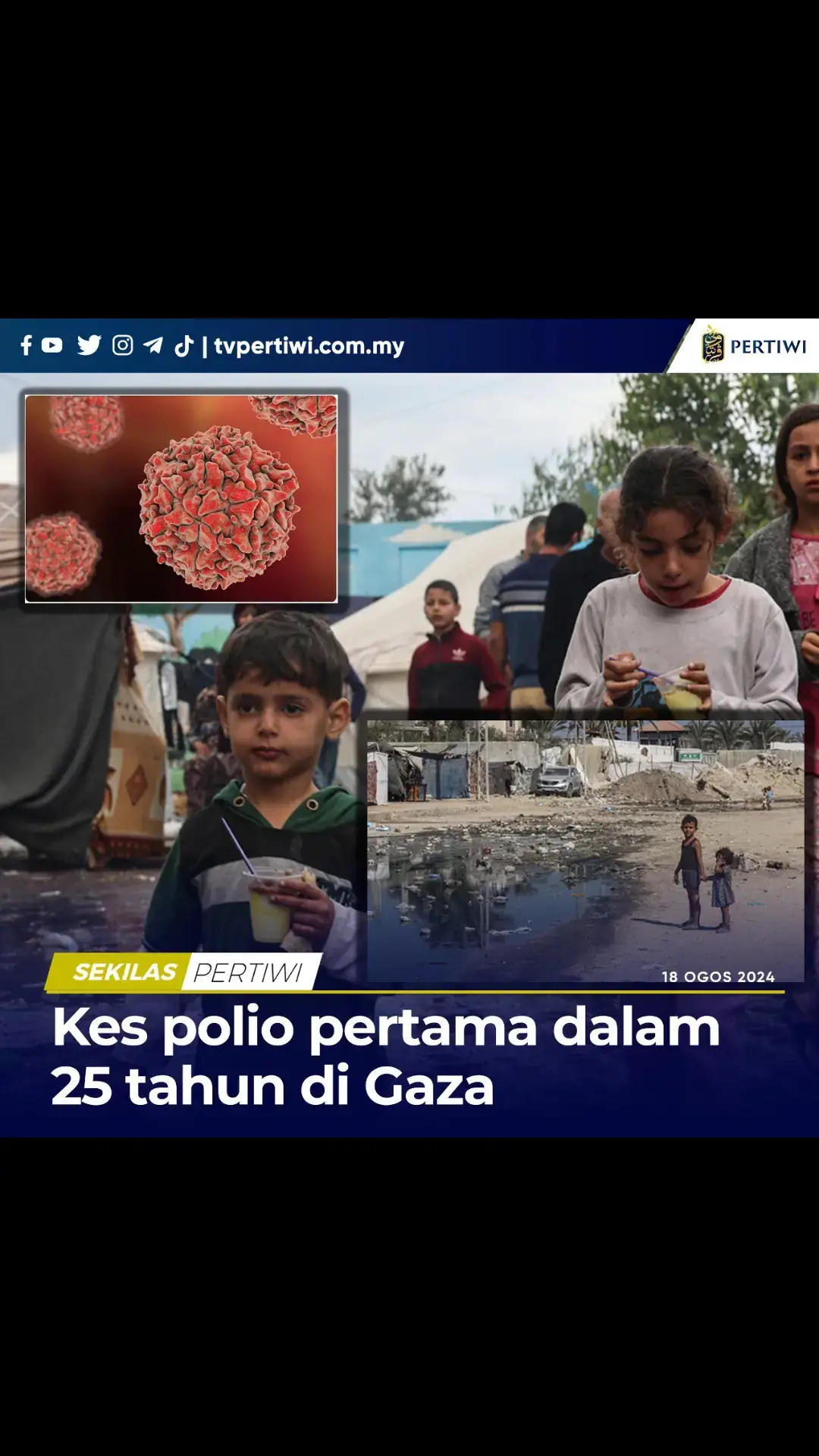 Kementerian Kesihatan Palestin telah melaporkan kes pertama polio yang disahkan di Gaza, dalam tempoh selama 25 tahun. Ia disahkan dihidapi oleh bayi berusia 10 bulan di Deir el-Balah yang tidak menerima sebarang vaksin polio. Perkembangan terkini isu kesihatan di Gaz4 itu diketahui beberapa jam selepas Setiausaha Agung Pertubuhan Bangsa-Bangsa Bersatu, PBB,  Antonio Guterres menggesa agar pertempuran dihentikan sementara bagi membolehkan kempen vaksinasi untuk kanak-kanak terhadap virus terbabit. Sumber : Al-Jazeera #boikotsampaimerdeka  Ikuti :  https://www.youtube.com/@beritapertiwi https://www.tiktok.com/@beritapertiwi https://t.me/tvpertiwi https://www.instagram.com/tvpertiwiofficial/ #TvPertiwi 