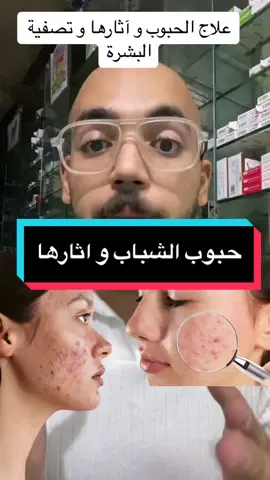 افضل كريم للحبوب و اثارها و الندبات و الحفر فى البشرة ✅ #حبوب_الشباب #حب_الشباب #آثار_حبوب #ندبات #حفر_الوجه #حبوب_الوجه #بشرة_صحية #بشرة_صافية #دكتور_عبدالرحمن_طارق #معلومة_فى_كبسولة💊 