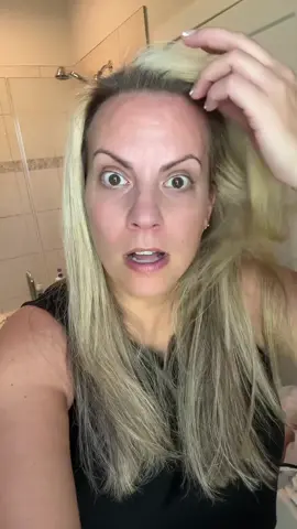 Final results of my Micro-Needling session. Im very happy with the results so far!!  #momtok #fypシ゚viral #FYP #creator #engaged #womensupportingwomen #microneedling #cosmetic #cosmeticprocedures #BeautyTok 