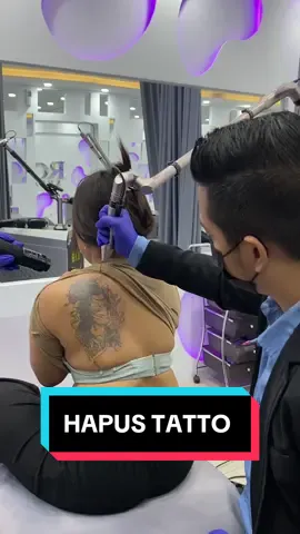 Hapus tatto merapat ✈️✈️✈️ @Sulam Alis Rosidi Master 🔥 #hapustatto #hapustattojakarta #sulamalisrosidi #lasertattooremoval 