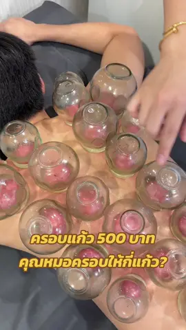ครอบแก้ว แก้ปวด 500 บาท ตุณหมอครอบให้กี่แก้ว? เป็นคำถามที่ที่มีคนถามเข้ามาเยอะเช่นกันค่ะ ตอนครอบทิ้งไว้ แต่คนใช้แก้วไม่เท่ากันขึ้นอยู่กับอาการและบริเวณที่ปวดด้วยค่ะ แต่โดยเฉลี่ยจะอยู่ที่ 12-20 แก้วค่ะ 😊 #ครอบแก้ว #ครอบแก้วรักษาอาการปวด #ครอบแก้วแก้ปวด #cupping #แพทย์แผนจีน #ปวดหลัง #ปวดคอบ่าไหล่ #ออฟฟิศซินโดรม #ฟาจินคลินิก 