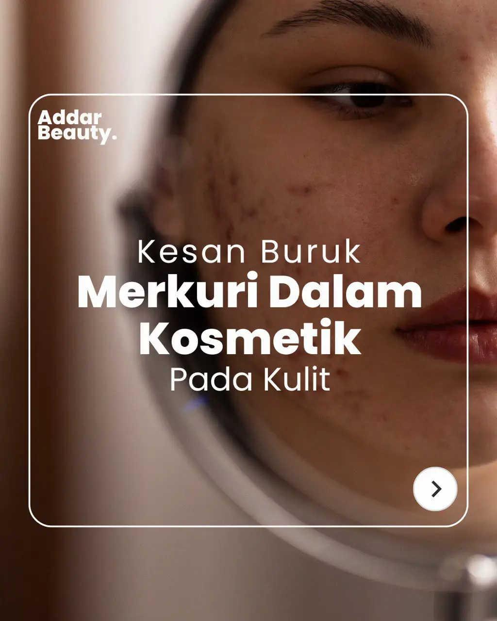 Banyak yang akan berlaku jika merkuri dipakai secara berterusan. Sayangilah kulit anda tanpa merkuri. Muka & badan nak pakai lama kan 😉  #solusikulitrosak #addarbeautyofficial #merkuriracun #SkinCare101 #fypシ゚viral 