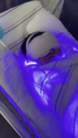 After spending four days at home, we found ourselves back at the birthing center due to jaundice.  As a mother, I was emotional as I watched her wrapped in UV lights all night long. After many many hours of her wrapped in UV lights, feeding every 2.5 hours and a handful of feet pricks for blood, her bilirubin levels went from 22 down to 12.5 and we were able to go home the following day.  My baby is a fighter… at least stronger than her mama.  #creatorsearchinsights #jaundice #newborn #newbornbaby #uv #emotionalmoments #hormones #tanning #babiesoftiktok 