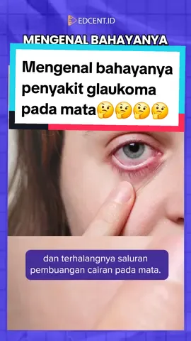 Glaukoma adalah penyakit mata yang dapat menyebabkan kebutaan atau kehilangan penglihatan. Glaukoma menyerang saraf mata, yang menghubungkan serat saraf dari retina menuju otak. Kerusakan saraf pada glaukoma umumnya terjadi akibat peningkatan tekanan bola mata. #serunyabelajar #glaukoma #kesehatan #taugasih 