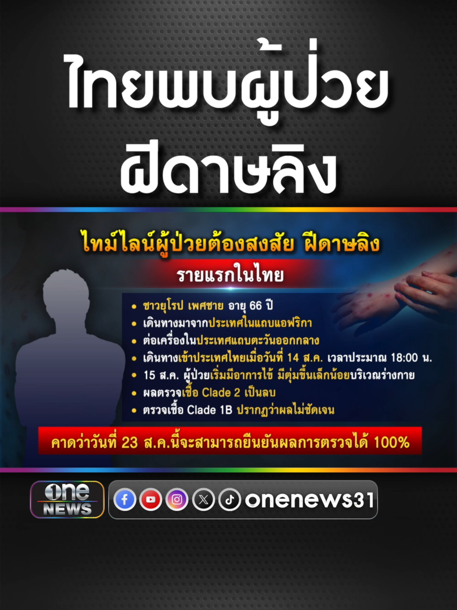 ไทยพบผู้ป่วย #ฝีดาษลิง รอผลตรวจยืนยันสายพันธุ์ #ข่าวช่องวัน #ข่าวtiktok #สํานักข่าววันนิวส์  #เอาให้ชัด #จั๊ดธีมะ