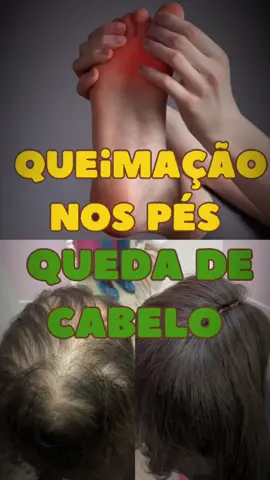 O ácido pantotênico, também conhecido como vitamina B5, é uma vitamina solúvel em água que faz parte do complexo B. É essencial para várias funções biológicas no corpo humano, incluindo o metabolismo de carboidratos, proteínas e gorduras, além da síntese de coenzima A, que é crucial para a produção de energia. O ácido pantotênico também desempenha um papel na produção de hormônios, como o cortisol, e na síntese de colesterol. Ele é importante para a saúde da pele, cabelos e olhos, e também ajuda na cicatrização de feridas. Fontes naturais de ácido pantotênico incluem carnes, ovos, grãos integrais, vegetais, e leguminosas. A deficiência dessa vitamina é rara, pois ela está amplamente distribuída nos alimentos, mas, quando ocorre, pode levar a sintomas como fadiga, insônia, irritabilidade, e formigamento nas mãos e pés. #lairribeiro #drlairribeiro #acidopatotenico #cabelo #quedadecabelo #saude 