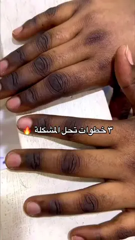 #مقشر_احماض_الفواكه_الامريكي #تفتيح_سريع_للجسم #خلطات_تفتيح_الجسم #تفتيح_البشرة #السعودية🇸🇦 
