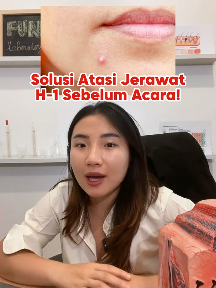 jerawat muncul h-1 sebelum acara? siapa ni yang sering kayak gini? hmm kira2 gimana ya solusinya? #funskincare #jerawat