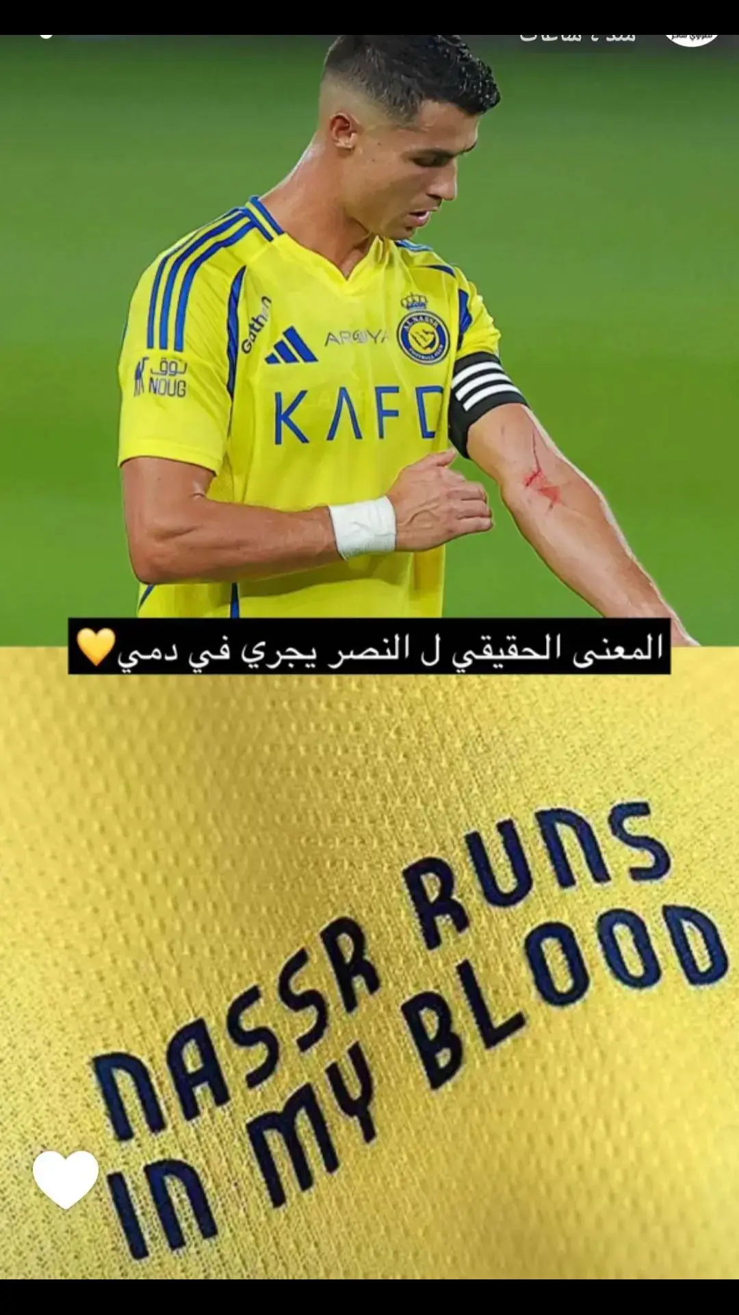 #النصر_هو_الحب_والعشق 💛💛💛💛