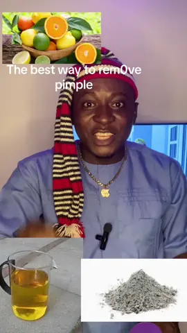 #viral #trending #tiktok #facebook #reels #comedy #everyone 