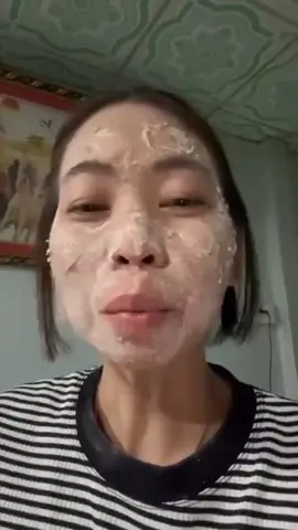 Peel tinh chất nuôi da rụng tàn nhang sau 3 ngày bong te tua #thinhhanhxuhuong #xuhuong #peeldasinhhọc #peelda #spa #taitao #namtannhang #thinhhanh #kemtrangda 