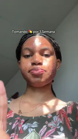 O processo é lento,más consigo sentir algumas mudanças…💕💁🏻‍♀️#fy #acneavançada #faniza #nivel2 #foryoupage #acne 