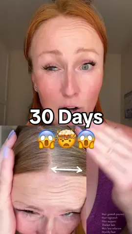 Unlock your hair's potential with natural hair growth solutions! 🌿 Say goodbye to thinning and hello to thicker, fuller hair. Ready to transform your hair care routine? @Hairfinity #HairGrowthJourney #HealthyHair #HairRegrowth #ThickerHair #NaturalHairGrowth #HairCareTips #StrongerHair #HairSupport #FullerHair #ScalpHealth #HairTransformation #HairVitamins