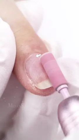 If you haven’t tried small sanding bands on natural nails… try GRIT 240! 😉It handles edges and improves your nail efficiency.  Super cute nail tools used:  #MelodySusie SM200F Plus nail drill and pink small sanding band. 💅	 #melodysusie #nailtool #nailtech #efile #naildrill #nailhacks #manicure #nailprep #gelremoval #soakoff  #fyp #fypシ゚viral #nails #nailfiling #nails #efile #sandingband #smallsandingband