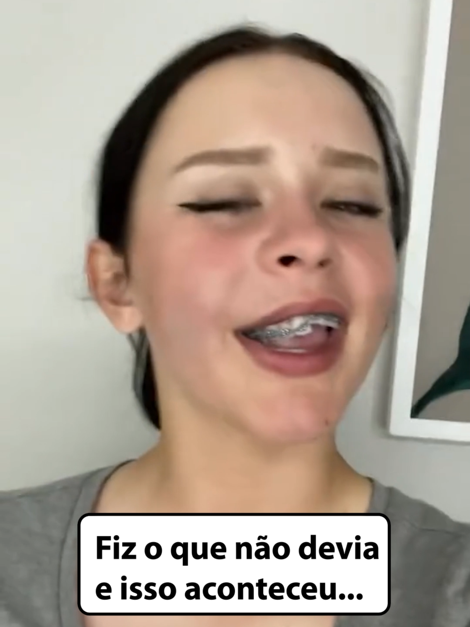 Ela quase perdeu os dentes por causa de briga!? 🦷😵 #dentista