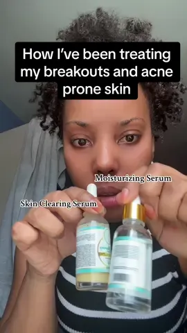 My skin has been breaking out over the last several months and its been difficult to get it under control. My usual skincare routine has not been working so i switched to skincare products from @TherapeuticHaven_Skincare and they have really helped to stop my breakouts. Ive been using the skin clearing serum and the moisturizing serum which contain skin clearing ingredients like Niacimamide, vitamin c, salicylic acid, and Hyaluronic acid with snail mucin. Ive tagged them here so you can check out all the skincare products they have to offer.