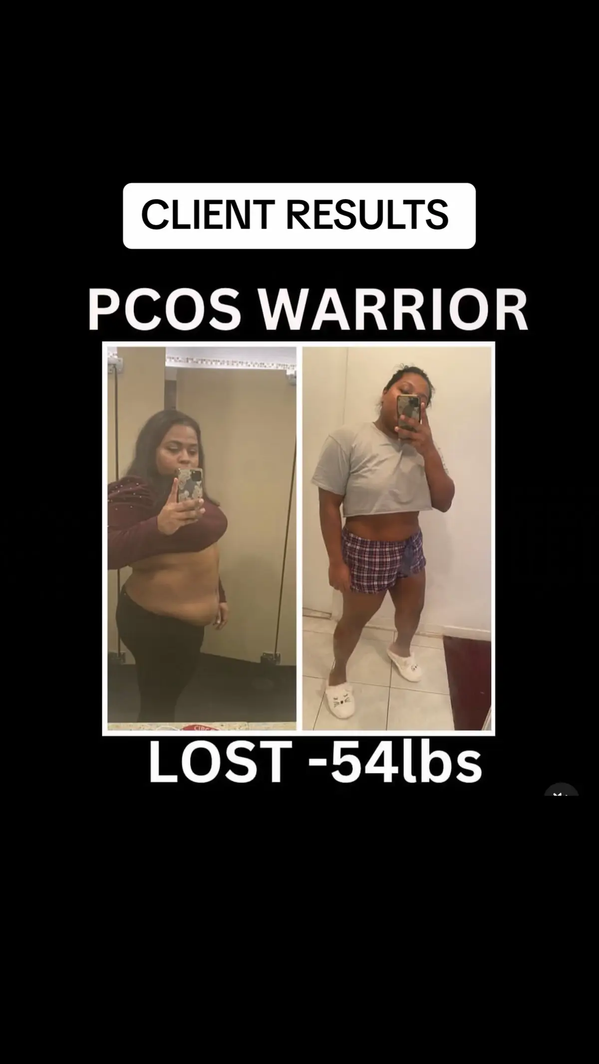 Pcos weight loss. Weight loss. Lose 50kg 