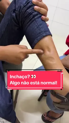 Você tem inchaço nas pernas? Isso pode ser por conta de vários motivos, um deles é problema renal! #nefrologia #nefro #drc #inchaconaspernas 