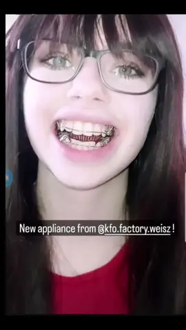 #tratamientoortodoncia #sonrisametalica #bracesgirl #braces #bracketsmetalicos #dientesdelata #brackets #tonguecrib #rejillalingual #sonrisaperfecta #bracesmile #ortodoncia #herbstappliance 